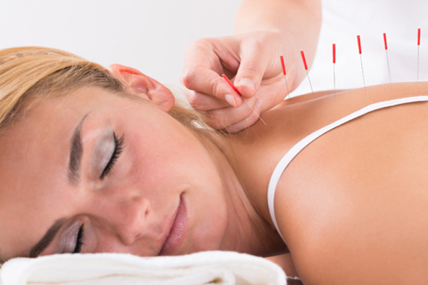 Acupuncture